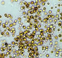 200px-EHP 3 Symbiodinium zooxanthellae.jpg