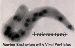 300px-Bacteria virus.jpg
