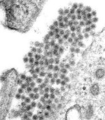 175px-Dengue-2 Virus Particles CDC.jpg