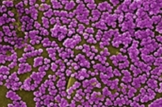 Methicillin-resistant Staphylococcus aureus...