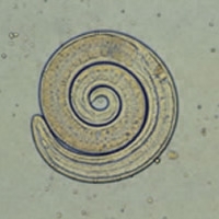 Trichinella larvaeG.JPG