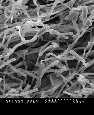 Scanning-elecetron-micrograpgh--28sem-29-of-powdery-mildew-on------fenugreek-leaf-surface-infected-with-erysiphe-polygoni.jpg