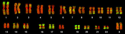  "Karyotype from a female human lymphocyte" Photo by Bolzer, Kreth, et al/ CC BY