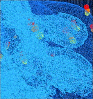 Computerized image showing wireframe representation of a fibroblast.