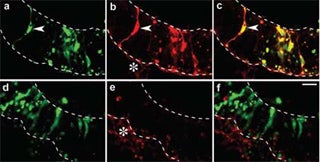 Photomicrograph of RNAi in mouse neuroepithelium.