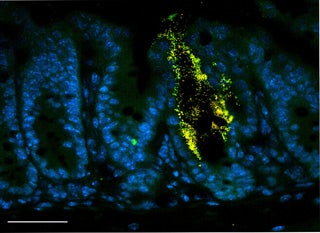 A micrograph of pathogenic bacteria (shown as yellow and green dots) attached to the lining of the intestine (shown as oval-shaped cells stained blue).