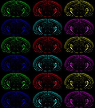 A multicolored montage of coronal sections of brains.