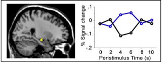 The hippocampus during conscious remembering of the past relative to memory based on stimulus familiarity.