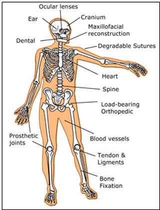 Diagram of the human body with locations for biomaterial applications.