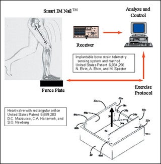 Diagram of bone strain system, showing implant in femur, standing on force plate, an exercise protocol, and receiver and analysis/control modules; and a patent diagram of the rectangular heart valve.