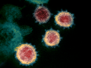 Four scattered spheres on a black background—these four spheres are of color-mixed in red and orange and have tiny green spikes on the fringe. Four scattered spheres on a black background—these four spheres are of color-mixed in red and orange and have tiny green spikes on the fringe.
