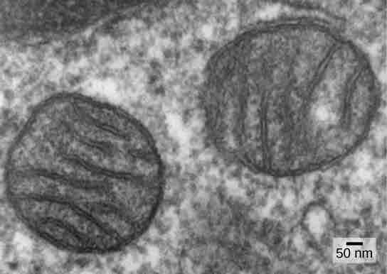 Micrograph of mammaliam mitochondria