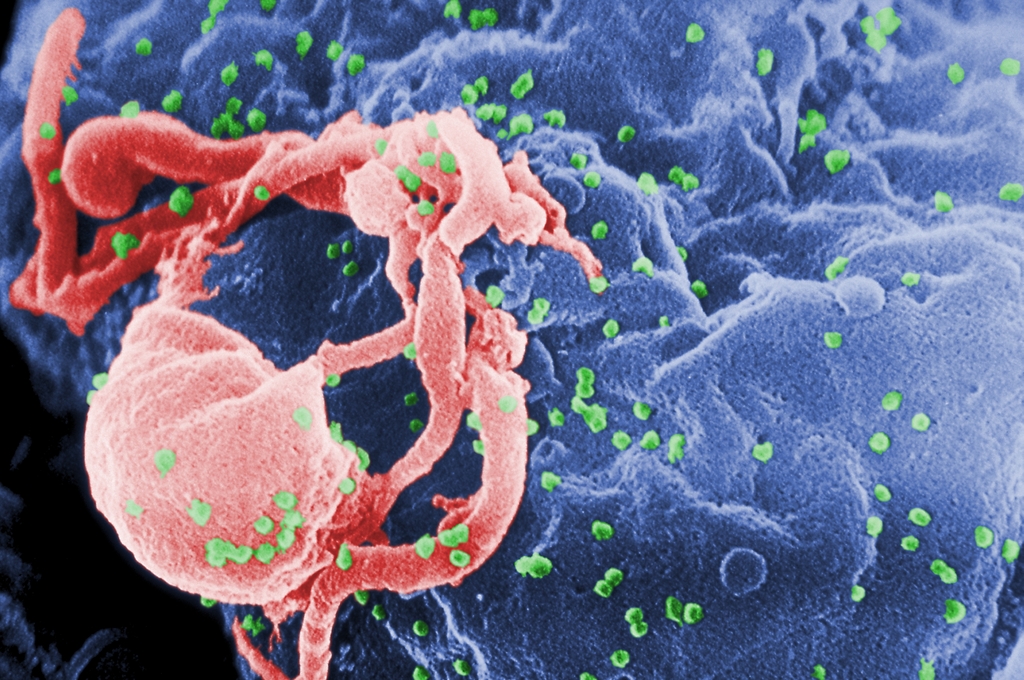 Image of HIV: scanning electron micrograph of HIV-1 budding (in green, color added) from cultured lymphocyte