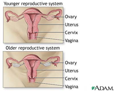 Menopause