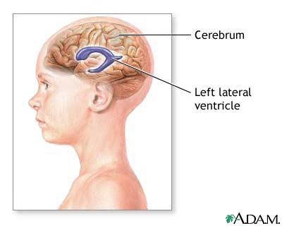 Ventricles of the brain