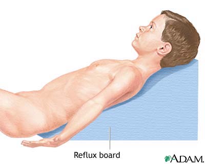 Reflux board