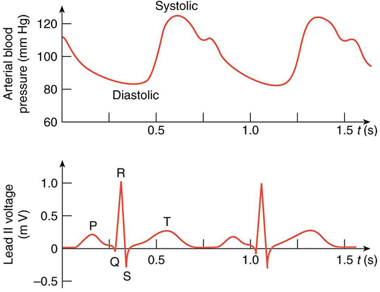 Image of an electrocardiogram with corresponding arterial blood pressure.